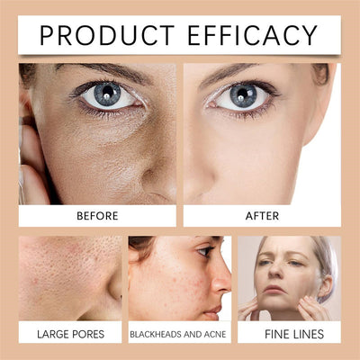 Whitening and blemish mask